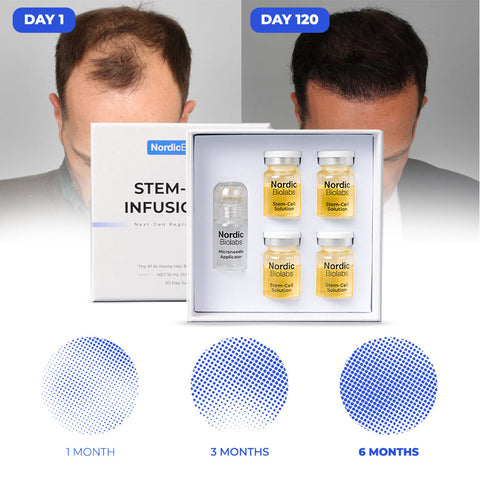 Stem Cell Infusion Kit